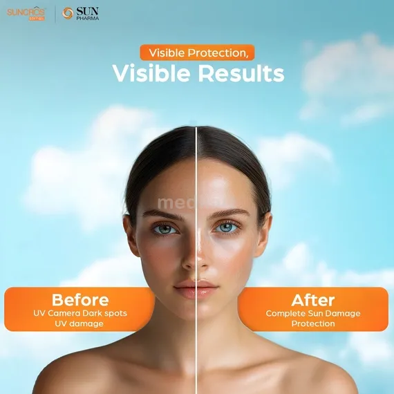 suncros soft gel 50 gm